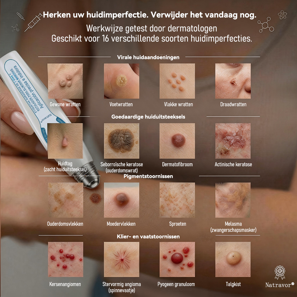 🍇Officiële merkshop | 🖊️Natravor® 7-daagse wratten- en vlekkenverwijderaar (pijnstillende applicator voor nauwkeurig aanbrengen, laat geen littekens achter)🌳