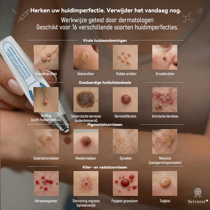 🍇Officiële merkshop | 🖊️Natravor® 7-daagse wratten- en vlekkenverwijderaar (pijnstillende applicator voor nauwkeurig aanbrengen, laat geen littekens achter)🌳
