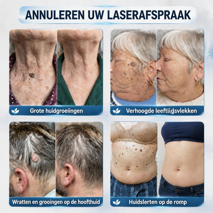 🍇Officiële merkshop | 🖊️Natravor® 7-daagse wratten- en vlekkenverwijderaar (pijnstillende applicator voor nauwkeurig aanbrengen, laat geen littekens achter)🌳